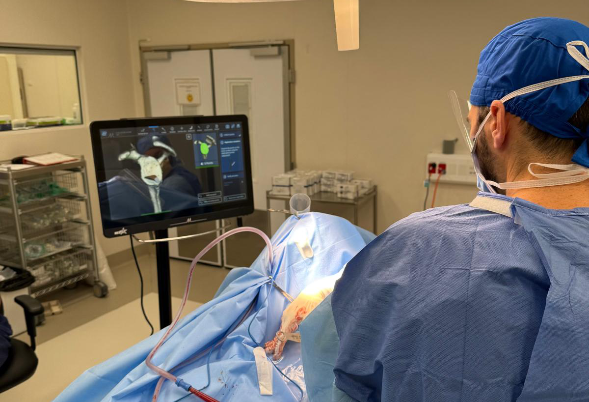 Patient-Specific Instrumentation (PSI) Navigation